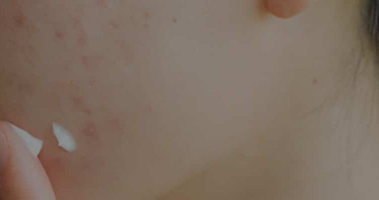 Global Dermatology Market