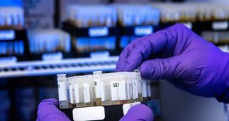 CAR-T Therapy Market