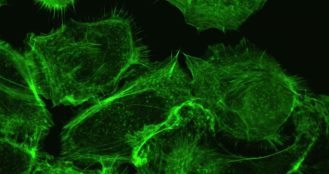 Live Cell Imaging Market