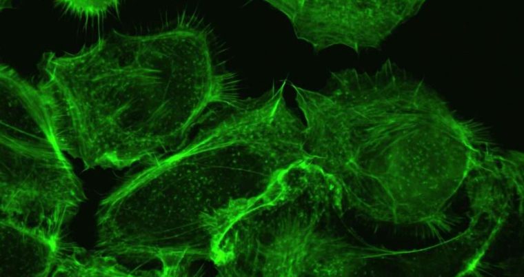 Live Cell Imaging Market