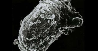 The UK’s Declining Access to Rare Disease Medicines: An Urgent Challenge