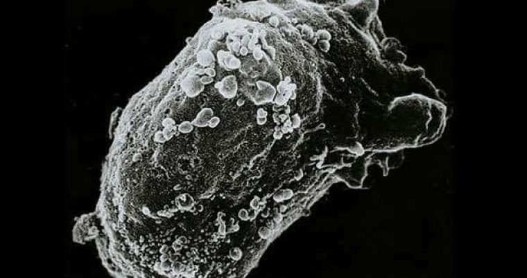 The UK’s Declining Access to Rare Disease Medicines: An Urgent Challenge