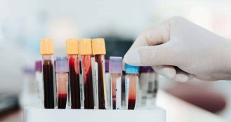 In Vitro Diagnostics Market