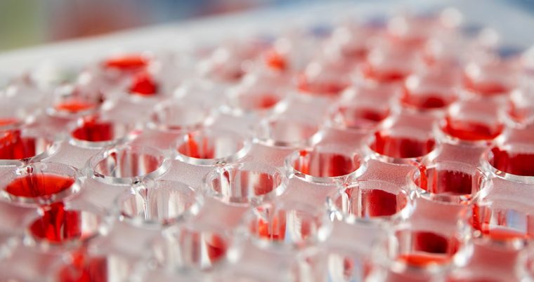 Scale vs Specialisation: Defining the Competitive Edge for CDMOs