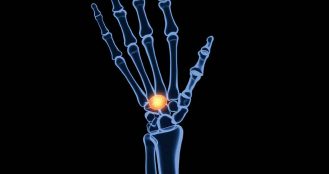 Rheumatoid Arthritis Drugs Market